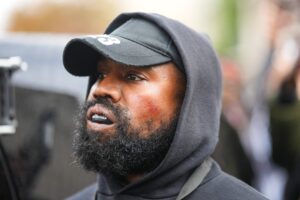 Kanye-West-Dentist-Teeth-Rumors-2363x1575.jpg
